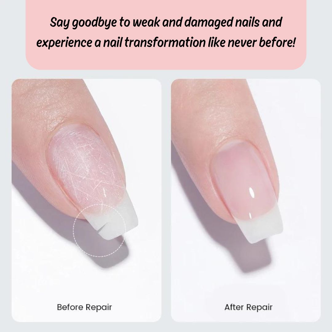 NailEssence™ Nail Repair Gel